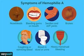 Image result for Hemophilia A Proteins