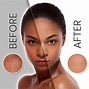 Image result for Blemish Cream for Black Skin