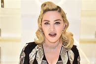 Image result for Madonna Hairline