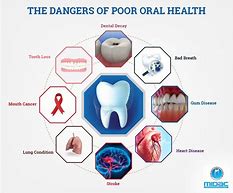 Image result for Bad Oral Care