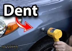 Image result for Removing Dent From Car