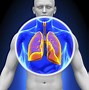 Image result for Metastatic Lung Cancer Symptoms
