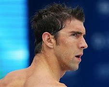 Image result for Fragile X Syndrome Michael Phelps