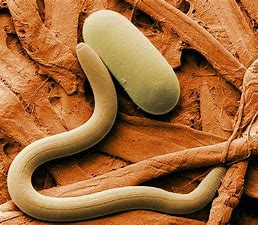 Image result for images intestinal worms