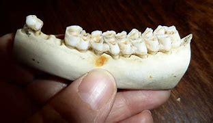 Image result for Head Dent
