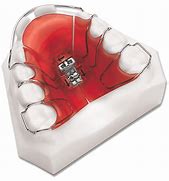 Image result for Removable Appliance