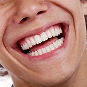 Image result for Healthy Teeth