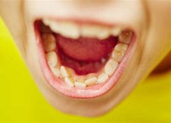 Image result for Well Teeth