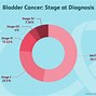 Image result for Cancer Stages 1-4