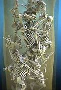 Image result for Jewish Skeleton Collection