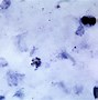 Image result for Plasmodium Falciparum Picture Under Microscope