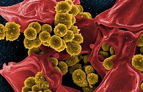 Image result for Superbug Virus