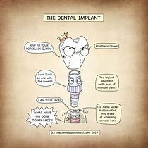 Image result for Printable Oral Surgeon Implant Jokes