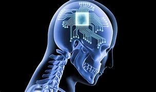 Image result for Neuro Link implant