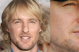 Image result for Owen Wilson Nose Story