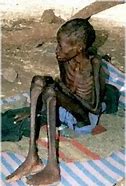 Image result for starving children 