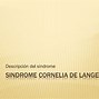Image result for Cornilus Syndrome