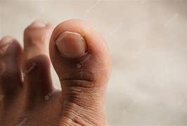 Image result for Finger Feet