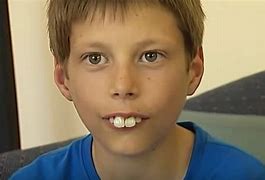 Image result for People with Big Teeth