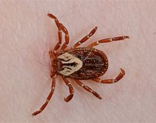 Image result for Types of Ticks