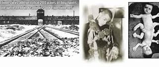 Image result for Josef Mengele List of Experiments