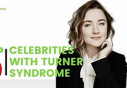 Image result for Famous Turner Syndrome Actress