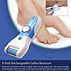 Image result for Electric Callus Remover with Dander Vacuum Cleaner