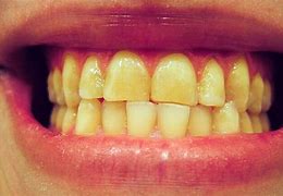 Image result for Dents Dings and Colors Shepherdsville KY