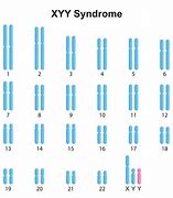 Image result for XYY Chromosome Disorder