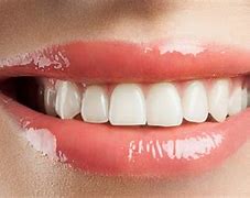 Image result for Natural Teeth Smile