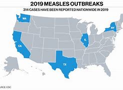 Image result for measles outbreak 2019