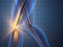 Image result for Osteoarthritis