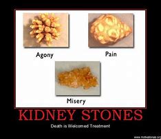 Image result for Jokes About Kidney Stones