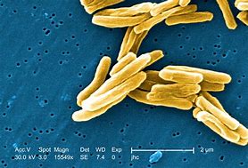 Image result for Mycobacterium Tuberculosis Bacteria