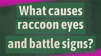 Image result for Raccoon or Battle Sign