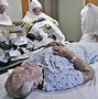 Image result for Smallpox Patient