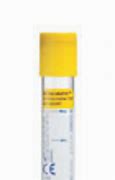 Image result for Bd Vacutainer Urine Collection Tubes