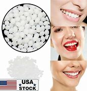 Image result for Dent Remover Repair Kit
