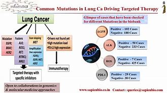 Image result for Small Cell Lung Cancer Chemotherapy