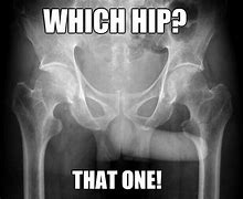 Image result for Funny X-ray Jokes Puns