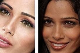 Image result for Skin Whitening Injection