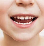 Image result for Dentition