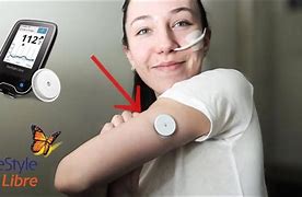 Image result for Freestyle Libre Sensor Placement