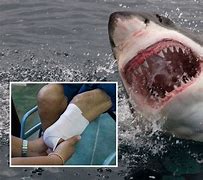 Image result for Shark attack Florida 