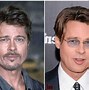 Image result for Best Plastic Surgery Before and After Men