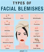 Image result for Types of Face Blemishes