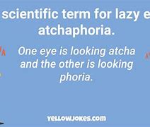 Image result for Eye Jokes One Liners