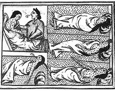 Image result for Aztec Smallpox