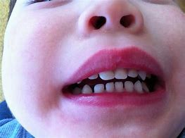 Image result for Clean Teeth