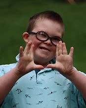 Image result for Down Syndrome